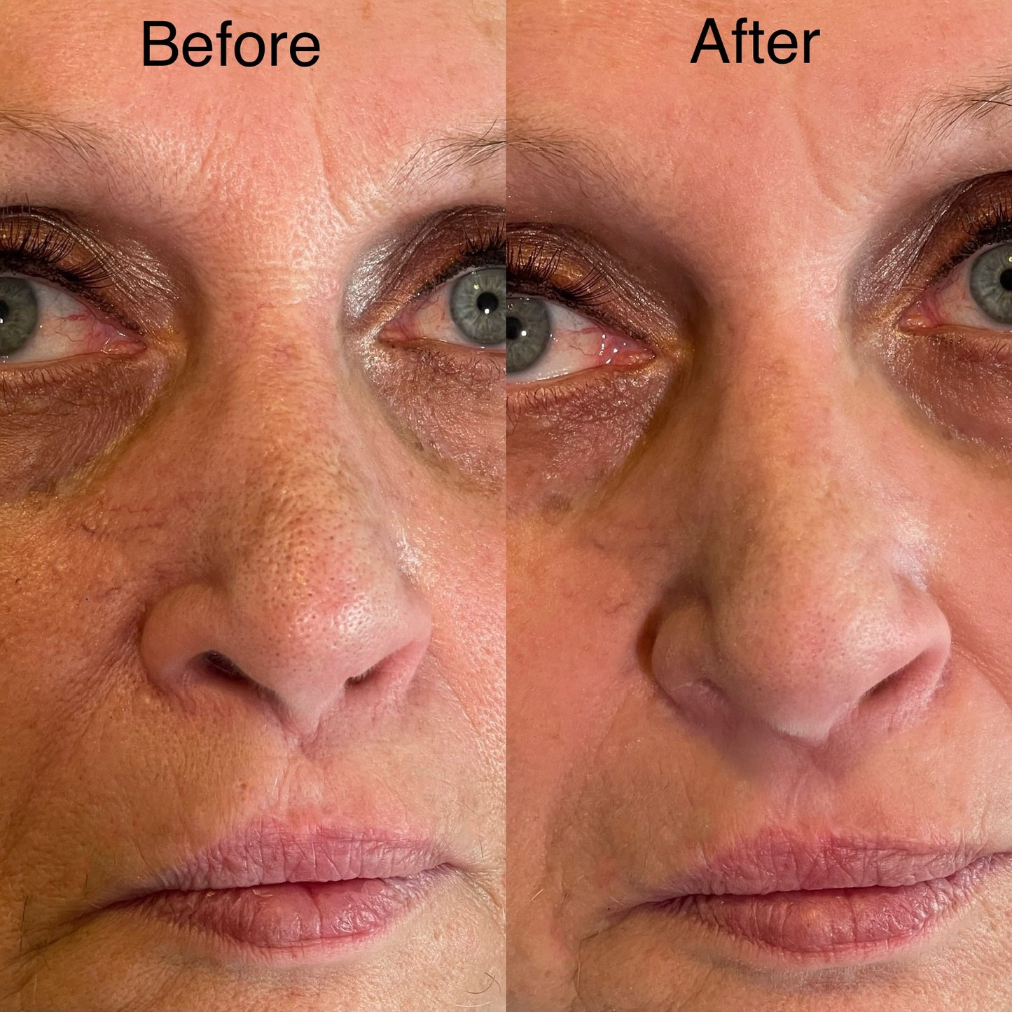 Careline Pore Minimizer Primer KFP